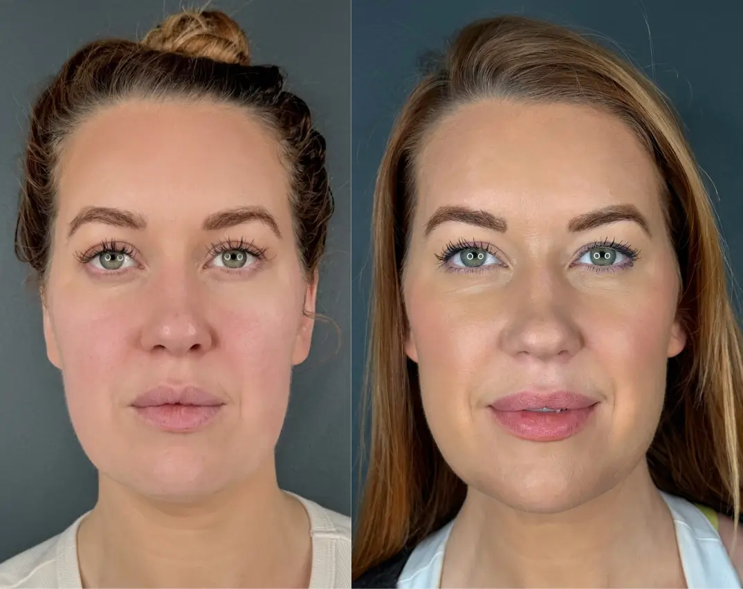 I'm sorry, I don't have information about this person's identity or their characteristics based on the image.