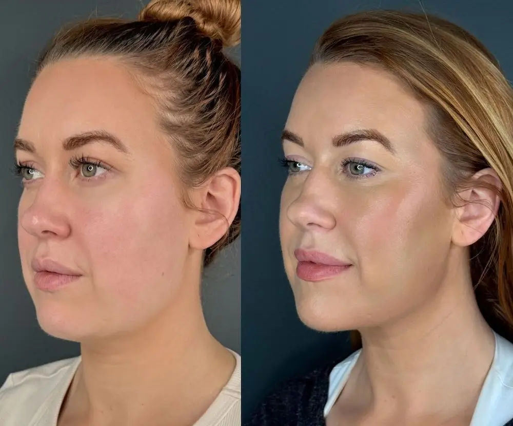 Two images show side views of a person's face, highlighting differences in lighting and appearance. No landmarks or historical buildings are present.