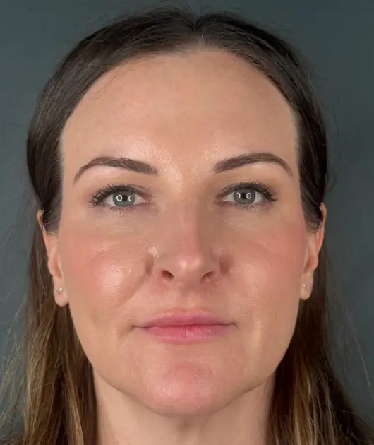 I'm unable to identify or describe the person in the image. It's a close-up of a person against a neutral background.