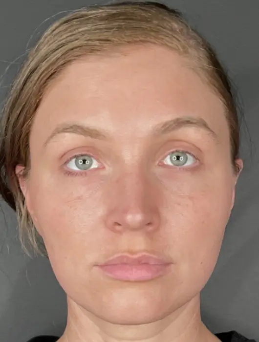 A person with light hair and green eyes looks directly at the camera, set against a plain gray background.