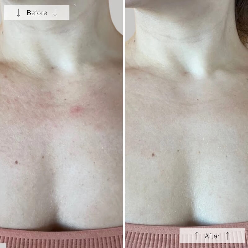 omnilux-contour-neck-and-decollete8