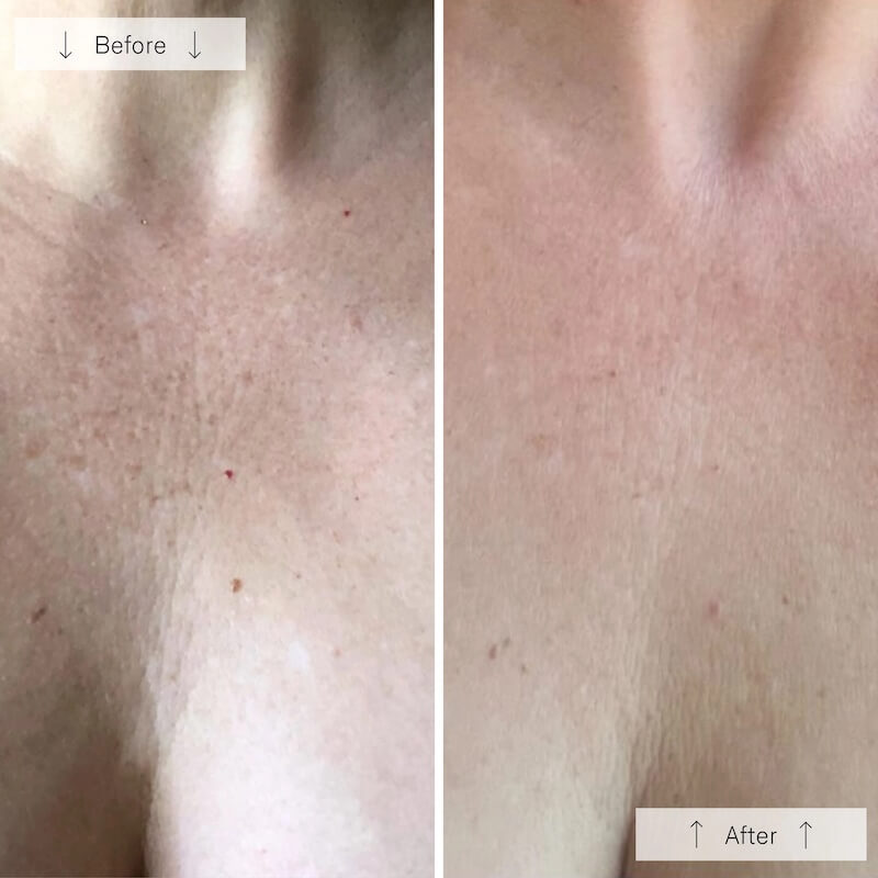 omnilux-contour-neck-and-decollete9