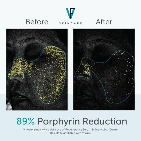 FACTORFIVE® Regenerative Serum - Image 4