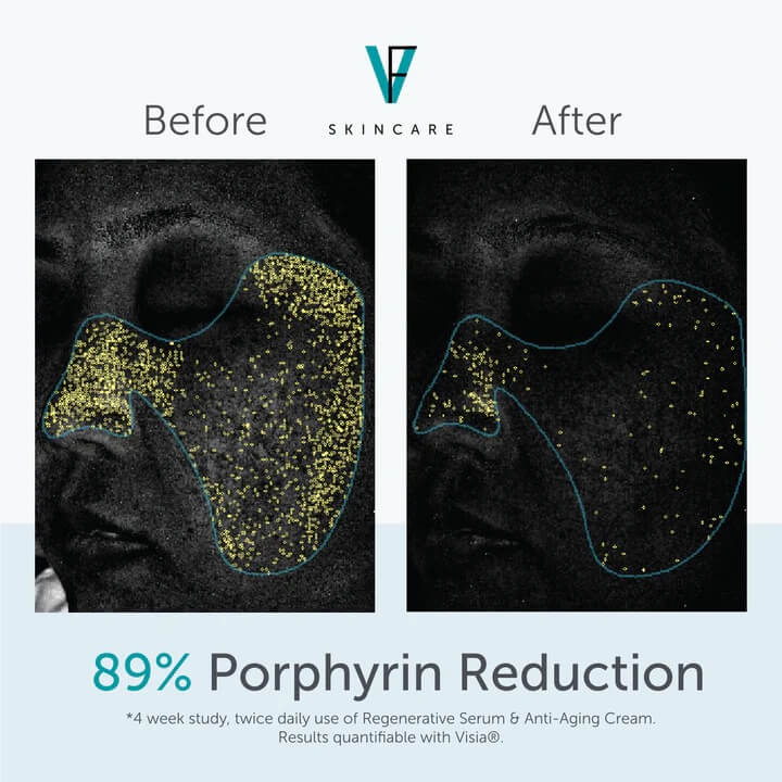 factorfive-regenerative-serum-4