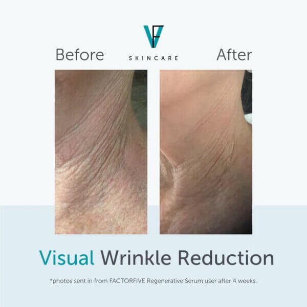 FACTORFIVE® Regenerative Serum - Image 3